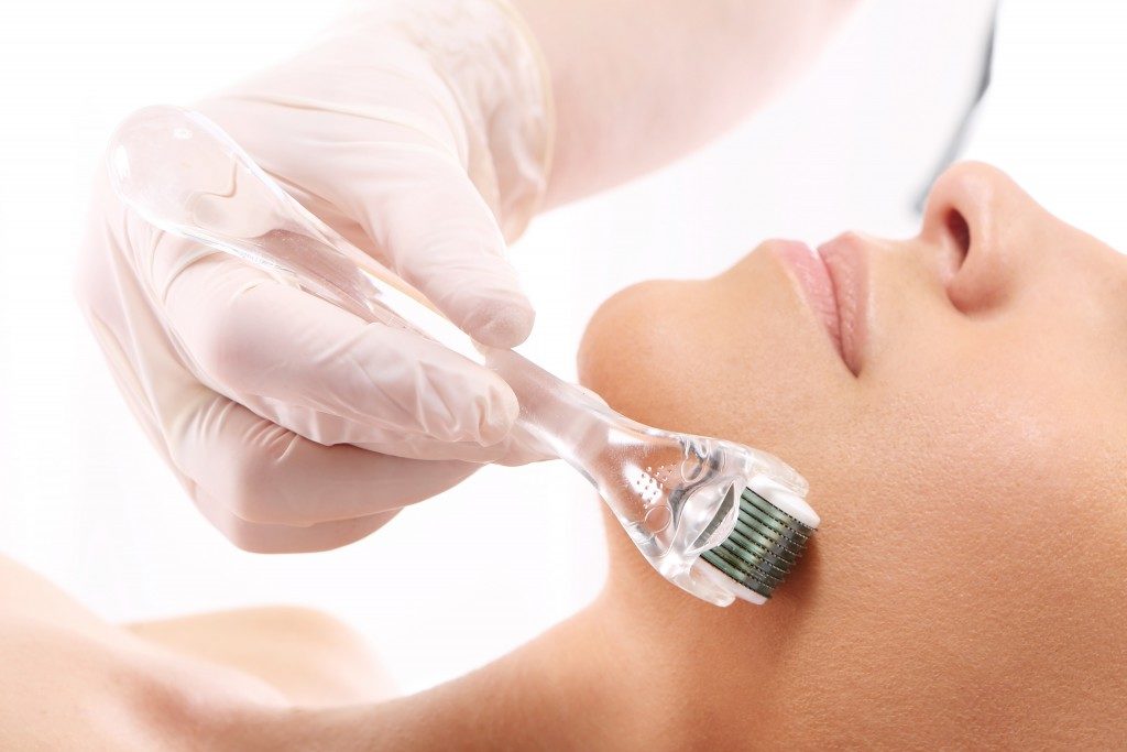 Woman during a microneedling procedure